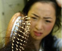 女性脱发是由那些因素导致